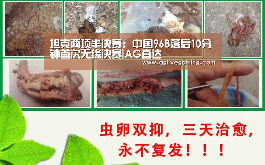 AG综合